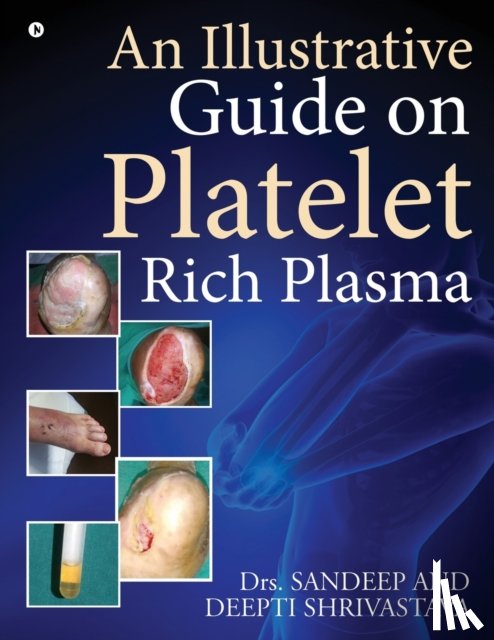 Dr Sandeep, Dr Deepti Shrivastava - An Illustrative Guide on Platelet Rich Plasma