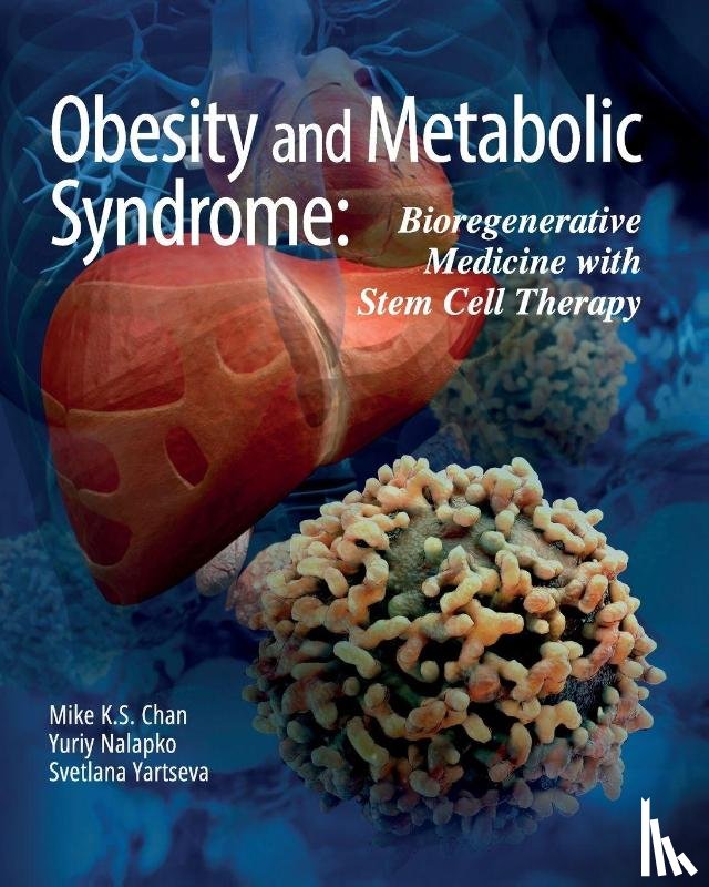 Chan, Mike K. S., Nalapko, Yuriy, Yartseva, Svetlana - Obesity and Metabolic Syndrome