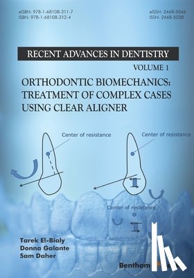 Galante, Donna - Orthodontic Biomechanics: Treatment Of Complex Cases Using Clear Aligner