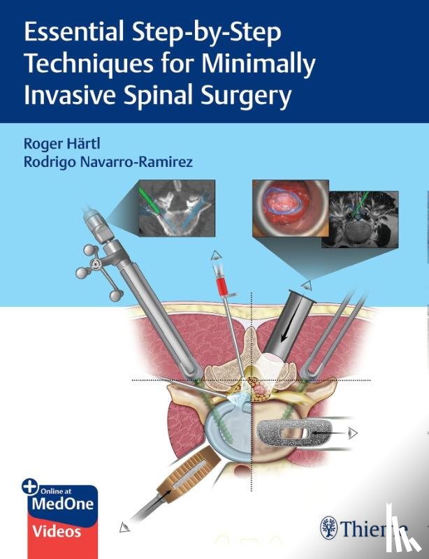 Hartl, Roger, Navarro-Ramirez, Rodrigo - Essential Step-by-Step Techniques for Minimally Invasive Spinal Surgery