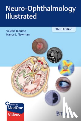 Biousse, Valerie, Newman, Nancy - Neuro-Ophthalmology Illustrated