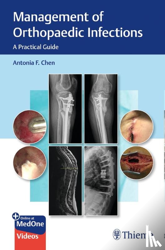 Chen, Antonia - Management of Orthopaedic Infections