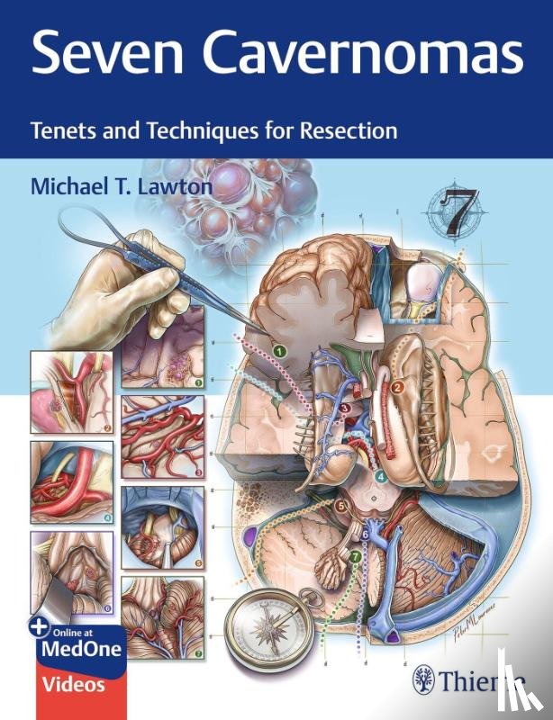 Lawton, Michael T. - Seven Cavernomas