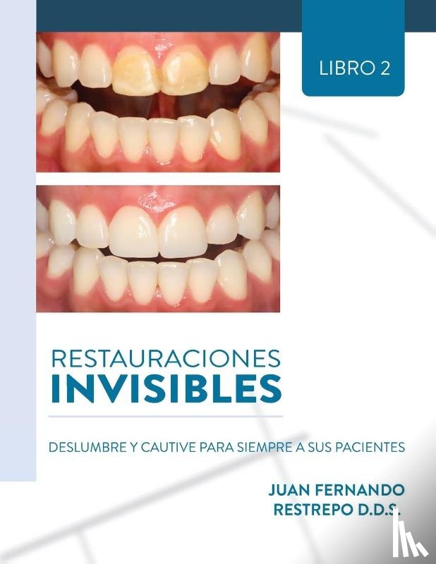 Fernando Restrepo, Juan - Restauraciones Invisibles