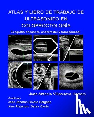 Herrero, Juan a Villanueva - Atlas y Libro de Trabajo de Ultrasonido en Coloproctologia