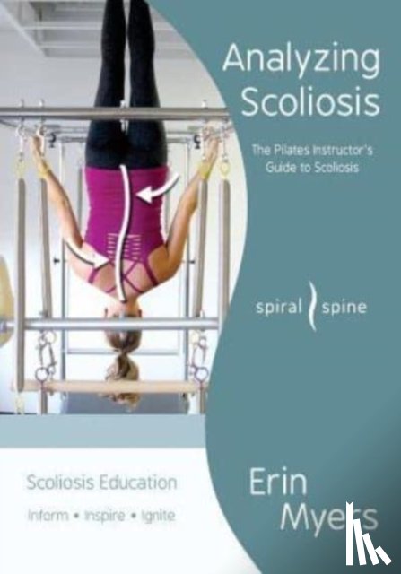 Myers, Erin - Analyzing Scoliosis