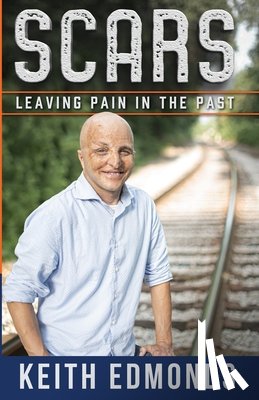 Edmonds, Keith - Scars Leaving Pain in the Past