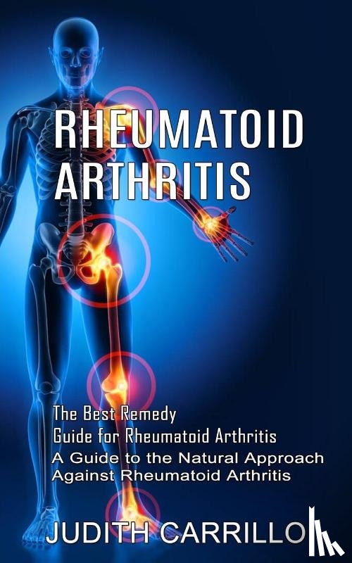 Carrillo, Judith - Rheumatoid Arthritis