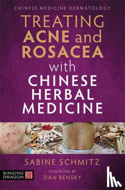 Schmitz, Sabine - Treating Acne and Rosacea with Chinese Herbal Medicine