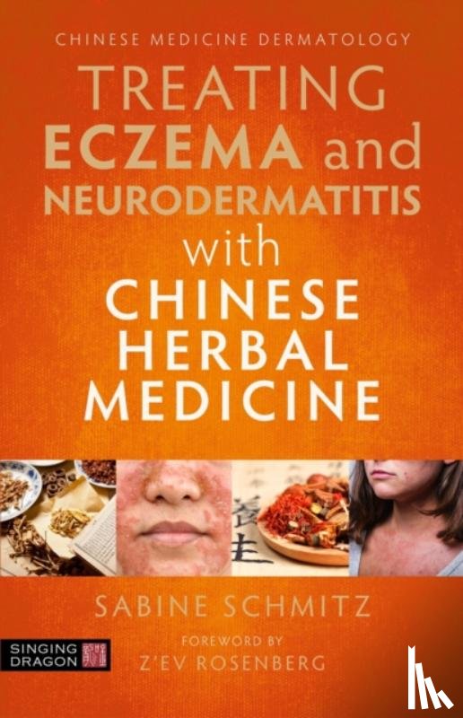 Schmitz, Sabine - Treating Eczema and Neurodermatitis with Chinese Herbal Medicine