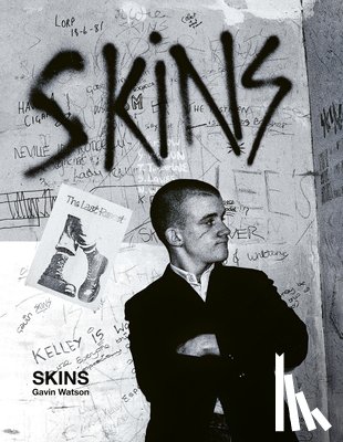 Watson, Gavin - Skins