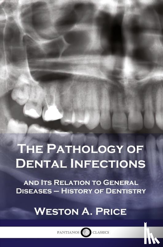 Price, Weston a - The Pathology of Dental Infections