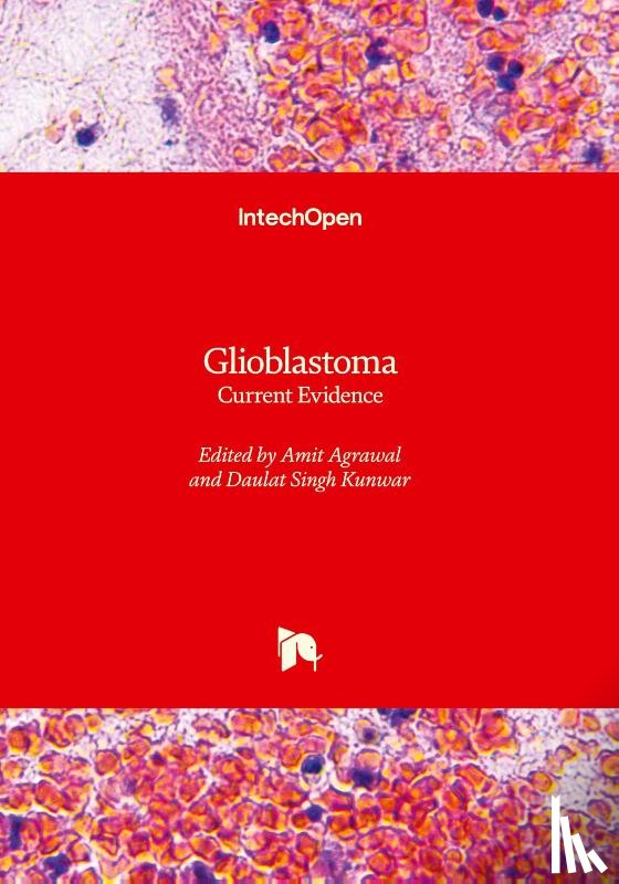  - Glioblastoma
