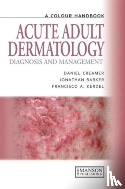 Creamer, Daniel, Barker, Jonathan, Kerdel, Francisco A. - Acute Adult Dermatology