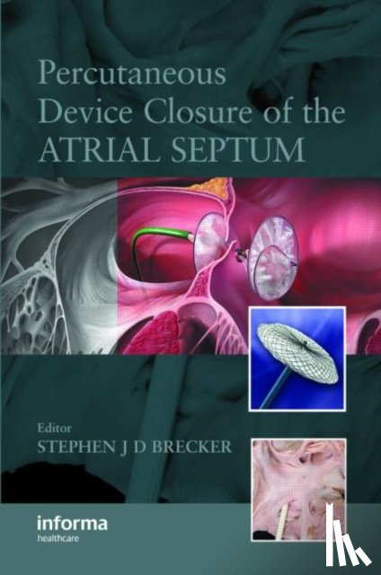  - Percutaneous Device Closure of the Atrial Septum