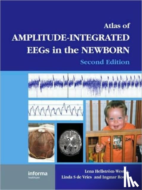  - An Atlas of Amplitude-Integrated EEGs in the Newborn