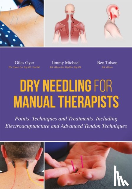 Gyer, Giles, Michael, Jimmy, Tolson, Ben - Dry Needling for Manual Therapists