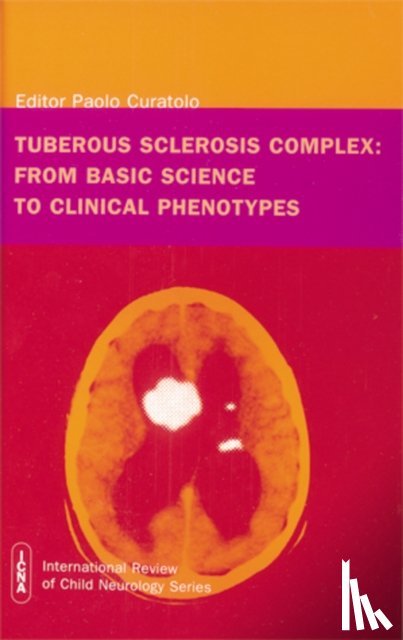  - Tuberous Sclerosis Complex
