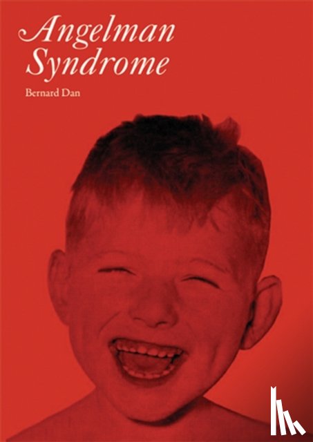 Dan, Bernard - Angelman Syndrome