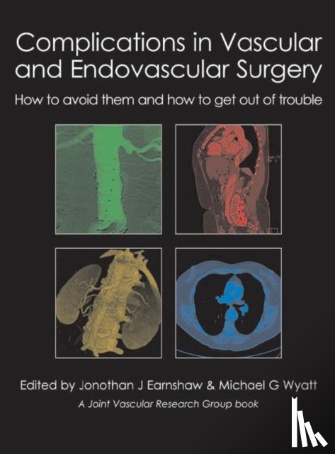  - Complications in Vascular and Endovascular Surgery