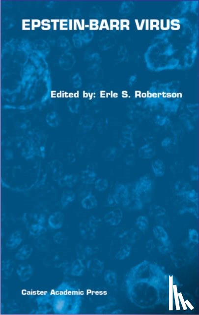  - Epstein-Barr Virus