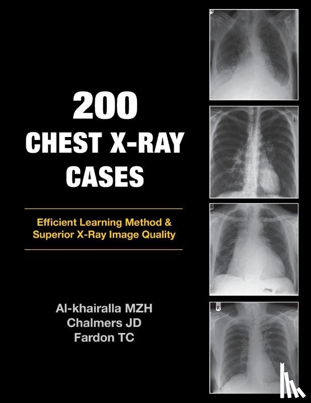 Al-khairalla, Mudher, Chalmers, James, Fardon, Tom - 200 Chest X-Ray Cases