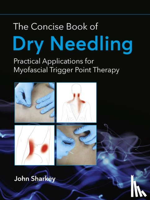 Sharkey, John - The Concise Book of Dry Needling