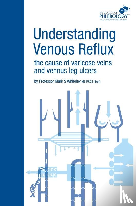 Whiteley, Mark S. - Understanding Venous Reflux the Cause of Varicose Veins and Venous Leg Ulcers