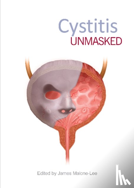  - Cystitis Unmasked