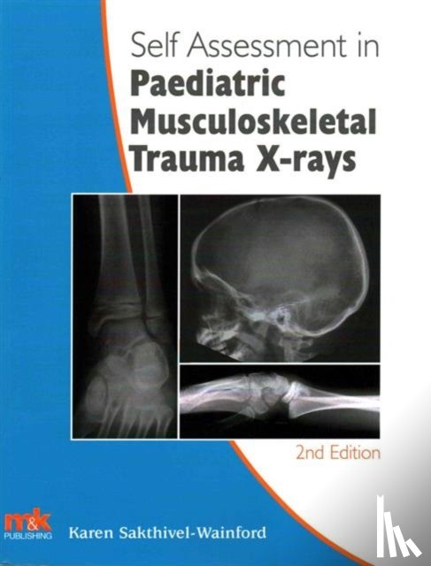 Sakthivel-Wainford, Karen - Self-Assessment in Paediatric Musculoskeletal Trauma X-Rays
