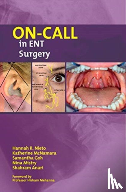 Nieto, Hannah, McNamara, Katherine, Goh, Samantha, Mistry, Nina - On-Call in ENT Surgery