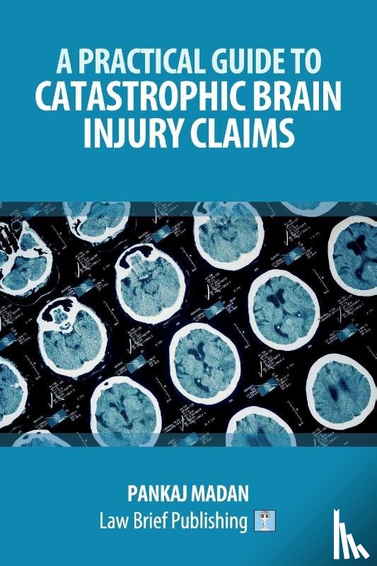 Madan, Pankaj - A Practical Guide to Catastrophic Brain Injury Claims