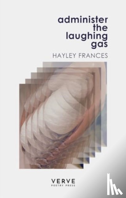 Frances, Hayley - Administer the Laughing Gas