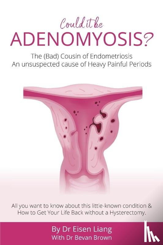 Liang, Eisen, Brown, Bevan - Adenomyosis -The Bad Cousin of Endometriosis