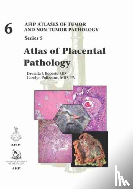 Roberts, Drucilla J., Polizzano, Carolyn - Atlas of Placental Pathology