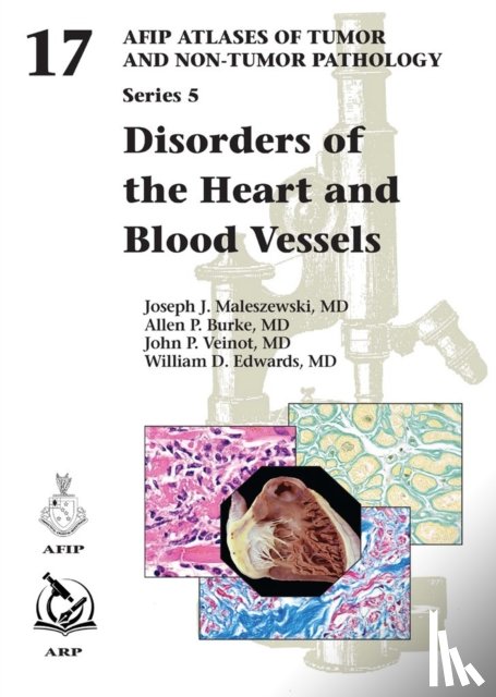 Maleszewski, Joseph J., Burke, Allen P., Veinot, John P., Edwards, William D. - Disorders of the Heart and Blood Vessels
