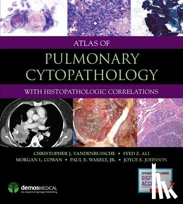 VandenBussche, Christopher J., Ali, Syed Z., Parwani, Anil V., Cowan, Morgan - Atlas of Pulmonary Cytopathology