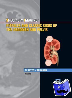 Khaled M. Elsayes, Akram A., MBBCh Shaaban - Specialty Imaging: Pitfalls and Classic Signs of the Abdomen and Pelvis - Pitfalls and Classic Signs of the Abdomen and Pelvis