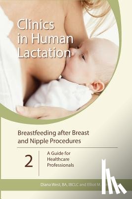 Diana West, Elliot M. Hirsch - Clinics in Human Lactation: v. 2 - Breastfeeding After Breast and Nipple Procedures