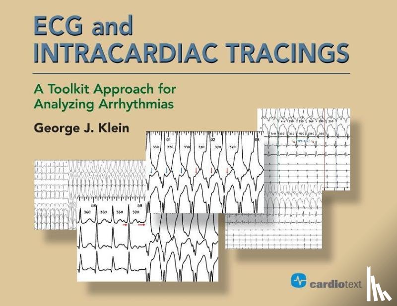 Klein, George J - ECG and Intracardiac Tracings