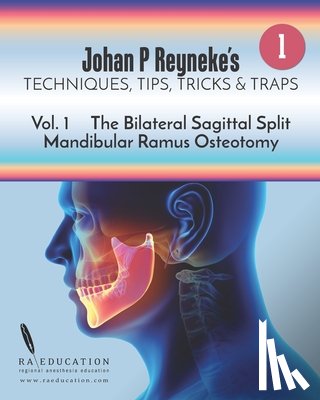 Reyneke, Johan P. - Johan P Reyneke's Techniques, Tips, Tricks and Traps: Volume 1: The Bilateral Sagittal Split Mandibular Ramus Osteotomy