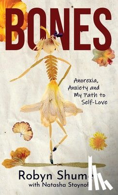 Shumer, Robyn, Stoynoff, Natasha - Bones