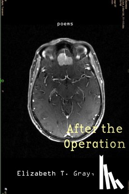 Gray, Elizabeth T. - After the Operation