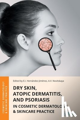 Hernandez-Jimenez, Elena - Dry Skin, Atopic Dermatitis, and Psoriasis in Cosmetic Dermatology & Skincare Practice