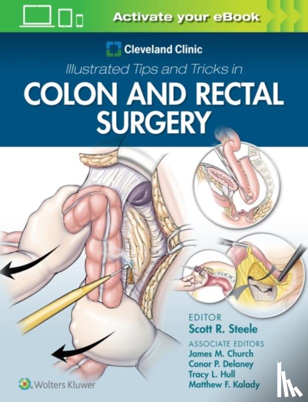 Steele, Scott - Cleveland Clinic Illustrated Tips and Tricks in Colon and Rectal Surgery