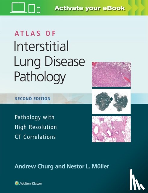 Churg, Andrew, Muller, Nestor L. - Atlas of Interstitial Lung Disease Pathology