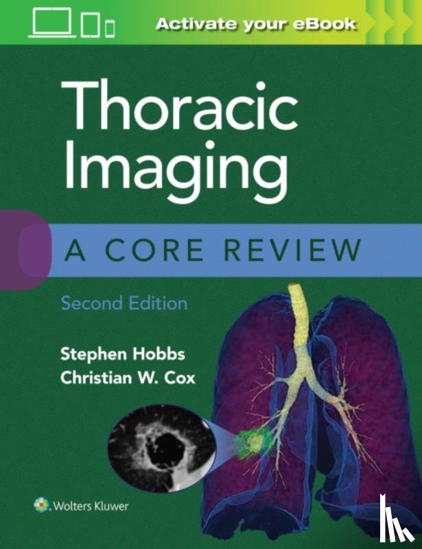 Hobbs, Stephen, Cox, Christian - Thoracic Imaging: A Core Review