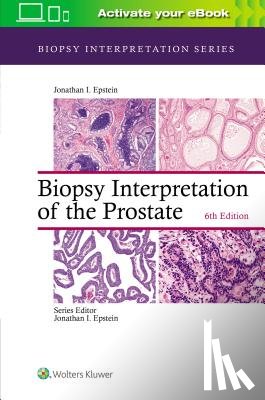 Epstein, Jonathan I. - Biopsy Interpretation of the Prostate