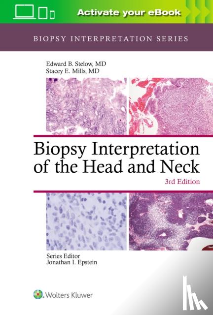 Stelow, Edward B., Mills, Stacey - Biopsy Interpretation of the Head and Neck