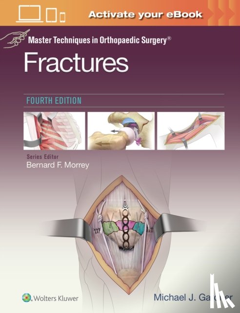 Gardner, Michael J. - Master Techniques in Orthopaedic Surgery: Fractures